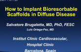 Case #6: How to Implant Bioresorbable Scaffolds in Diffuse Disease (With Discussion)