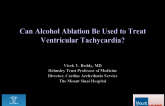 Can Alcohol Ablation Be Used to Treat Ventricular Tachycardia?