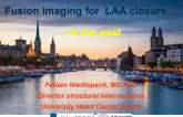 Debate: Fusion Imaging for LAA Closure Is the Past!