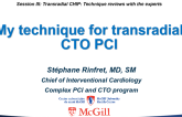 My Technique for: Transradial CTO PCI
