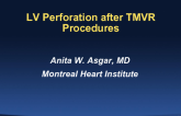 LV Perforation After Transcatheter Mitral Valve Procedures: Frequency, Treatment Options, and Outcomes