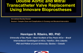 Case #2: Double Aortic and Mitral Transcatheter Valve Replacement Using Innovative Bioprostheses
