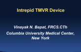Established TMVR 4: Intrepid - Device Description, Strengths and Weaknesses, and Updated Summary Outcomes