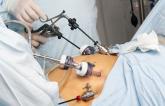 Sustained Blood Pressure Reductions With Gastric Bypass Surgery: GATEWAY