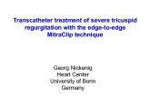 Transcatheter TR Solution 3: MitraClip