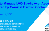 How to Manage LVO Stroke With Access Blocked by Cervical Carotid Occlusion