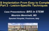 Case Presentations: BRS in STEMI