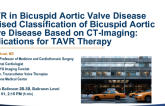 Revised Classification of Bicuspid Aortic Valve Disease Based on CT-Imaging: Implications for TAVR Therapy