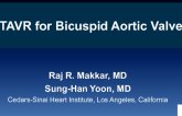 Outcomes after TAVR in Bicuspid vs Tricuspid Aortic Valves: Results From a Multicenter Study with Propensity Matching