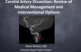 Carotid Artery Dissection: Review of Medical Management and Interventional Options