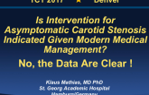 Flash Debate 1: Is Intervention for Asymptomatic Carotid Stenosis Indicated Given Modern Medical Management? No, the Data Are Clear!