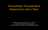 Transcatheter Tricuspid Intervention With a Twist