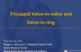 Tricuspid Valve-in-Valve and Valve-in-Ring