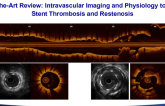 State-of-the-Art Review: Intravascular Imaging and Physiology to Evaluate Stent Thrombosis and Restenosis