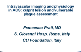 State-of-the-Art Review: Intravascular Imaging and Physiology in ACS - Culprit Lesion and Vulnerable Plaque Assessment
