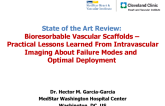 State-of-the-Art Review: Bioresorbable Vascular Scaffolds – Practical Lessons Learned From Intravascular Imaging About Failure Modes and Optimal Deployment