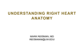Understanding Right Heart Anatomy