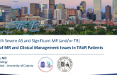 Frequency of MR and Clinical Management Issues in TAVR Patients