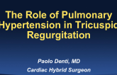 The Role of Pulmonary Hypertension in Tricuspid Regurgitation