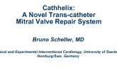 Cathhelix: A Novel Trans-catheter Mitral Valve Repair System
