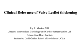 The Clinical Relevance of Valve Leaflet Thickening after TAVR