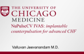 NuPulse: Implantable Counterpulsation for Advanced CHF
