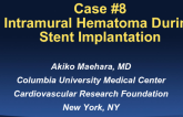 Case #8 (With Discussion): Intramural Hematoma After Stent Implantation
