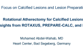 Rotational Atherectomy for Calcified Lesions: Insights From ROTAXUS, PREPARE-CALC, and More