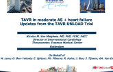 TAVR in Moderate Aortic Stenosis + Heart Failure: Updates From the UNLOAD Trial