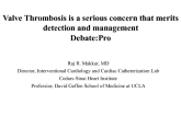 Flash Debate: Valve Thrombosis After TAVR Is a Serious Concern That Deserves Detection and Management!