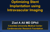 State-of-the-Art Review: Intravascular Imaging and Physiology to Optimize Stent Implantation Procedures
