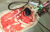 TRICS III: Restrictive Red-Cell Transfusion Noninferior to Liberal Use in Cardiac Surgery