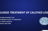 OCT Guided Treatment of Calcified Lesions