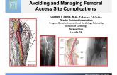 Avoiding and Managing Femoral Access Site Complications