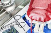 New Guideline Aims to Standardize Anticoagulation During Cardiopulmonary Bypass