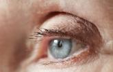 NOACs May Carry Lower Risk of Intraocular Hemorrhage Than Warfarin