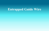 Entrapped Guide Wire 