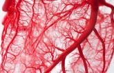 Complete Revascularization for STEMI the Way to Go Even Though Evidence Isn’t Definitive: Meta-analysis