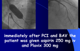 Case: Immediately after PCI and BAV the patient was given aspirin 250 mg iv and Plavix 300 mg
