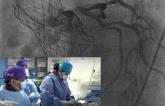 Coronary Procedures After TAVR: New Practical Guide Reviews Tools, Techniques