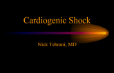 Cardiogenic Shock