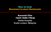 How to treat: Recurrent In-stent Restenosis