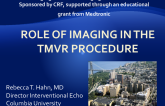 Role of Imaging in the TMVR Procedure