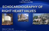 Echocardiography of Right Heart Valves