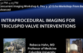 Intraprocedural Imaging For Tricuspid Valve Interventions