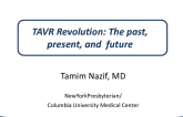 The TAVR Revolution: Past, Present and Future