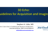 3D Echo: Guidelines for Acquisition and Imaging
