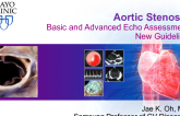 Aortic Stenosis: Basic and Advanced Echo Assessment New Guideline