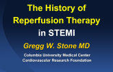 The History of Reperfusion Therapies in STEMI: How Far We've Come