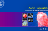 Aortic Regurgitation Nuances in Echo